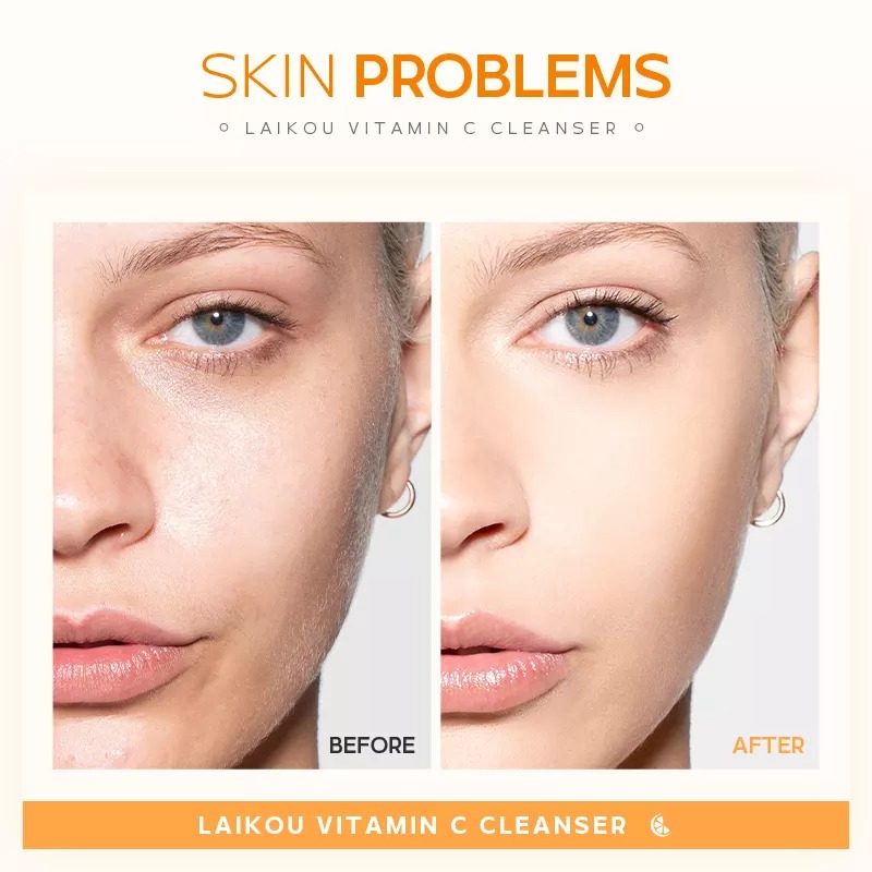 Laikou Vitamin C Cleanser - 50 g