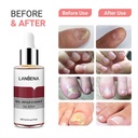 Lanbena Nail Repair Essence Serum -15ml