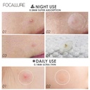 FA186 - Focallure ACNE PIMPLE Night Patch